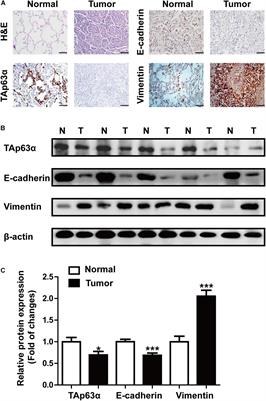 TAp63α Is Involved in Tobacco Smoke-Induced Lung Cancer EMT and the Anti-cancer Activity of Curcumin via miR-19 Transcriptional Suppression